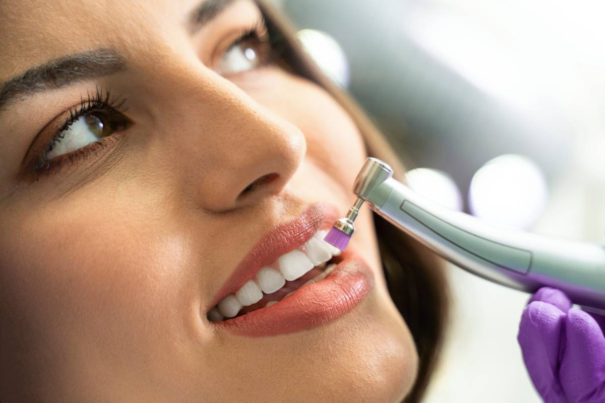 Does Teeth Cleaning Remove Cavities