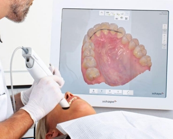 The dentist scans the patient's teeth with a 3d scanner stock image